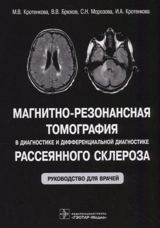 

Магнитно-резонансная томография в диагностике и дифференциальной диагностике рассеянного склероза. Руководство для врачей