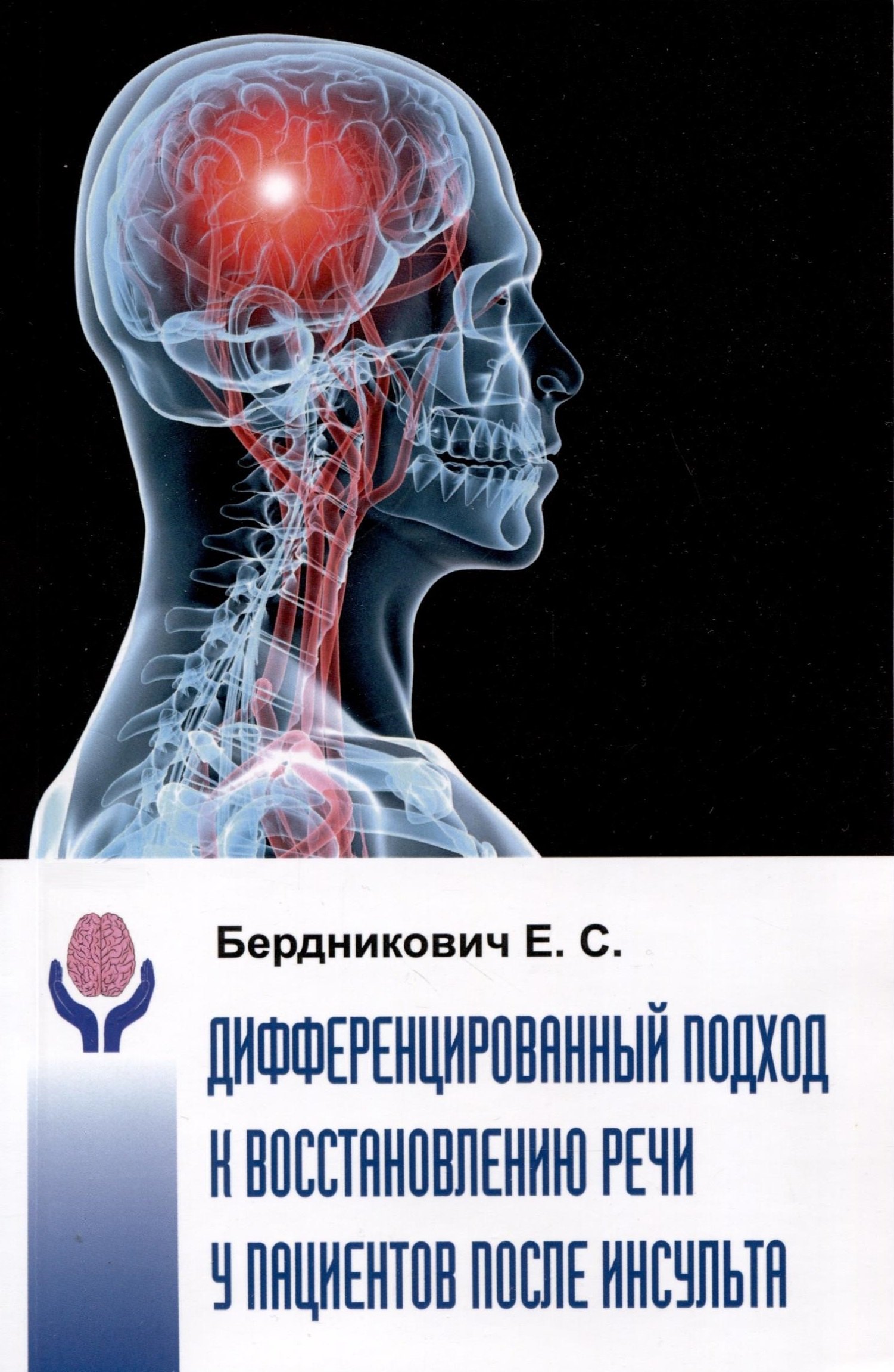 Дифференциальный подход к восстановлению речи у пациентов после инсульта