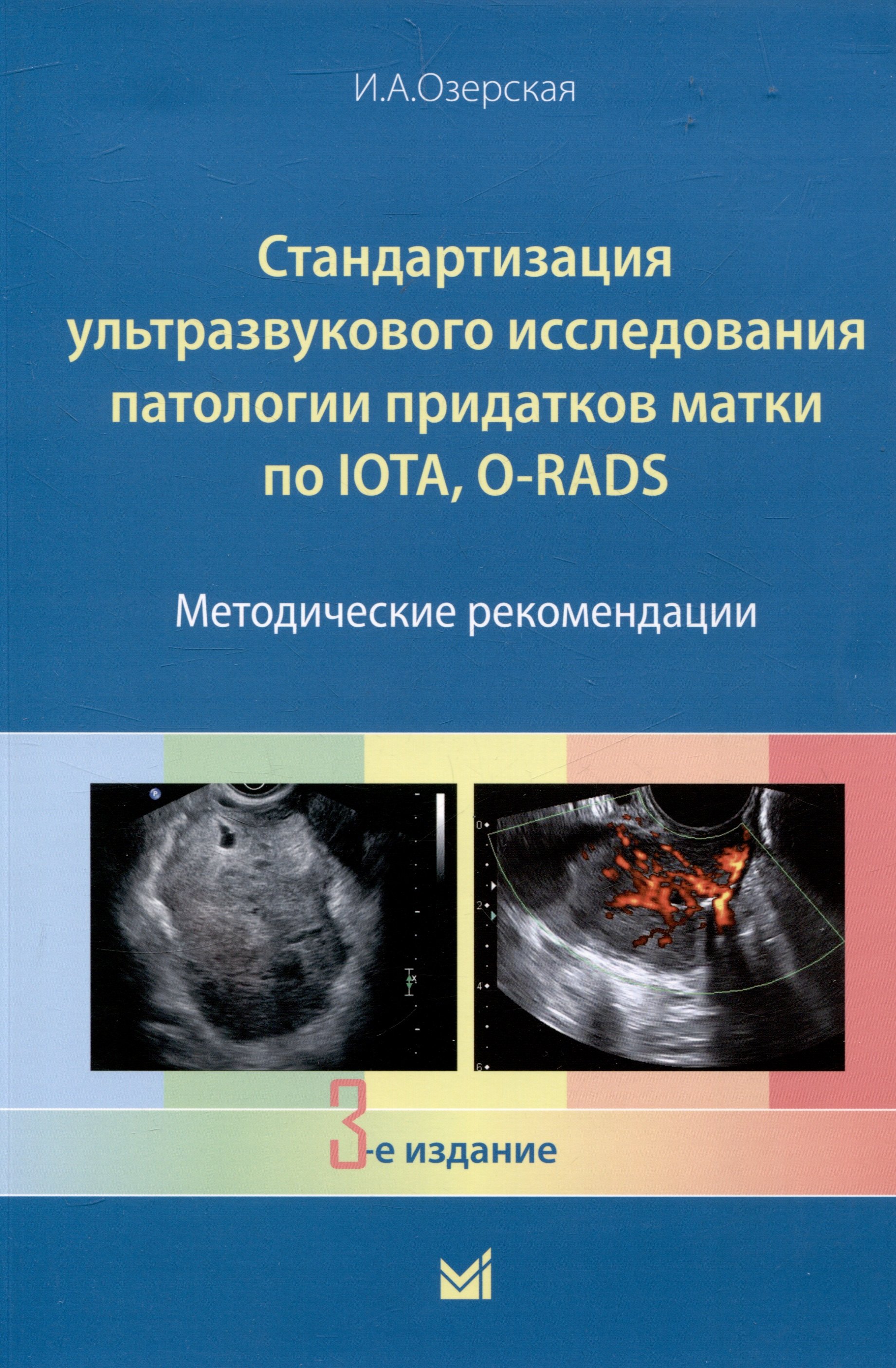 Стандартизация ультразвукового исследования патологии придатков матки по IOTA, O-RADS. Методические рекомендации