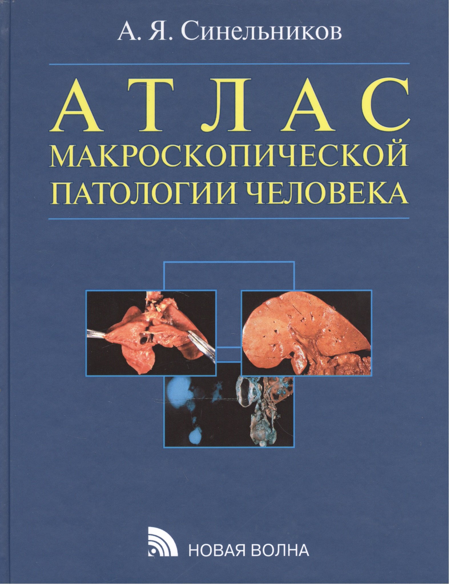 

Атлас макроскопической патологии человека: учебное пособие