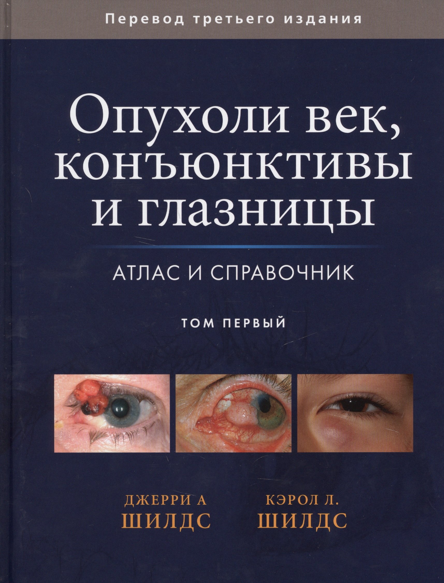 Опухоли век, конъюктивы и глазницы. Атлас и справочник. Том 1