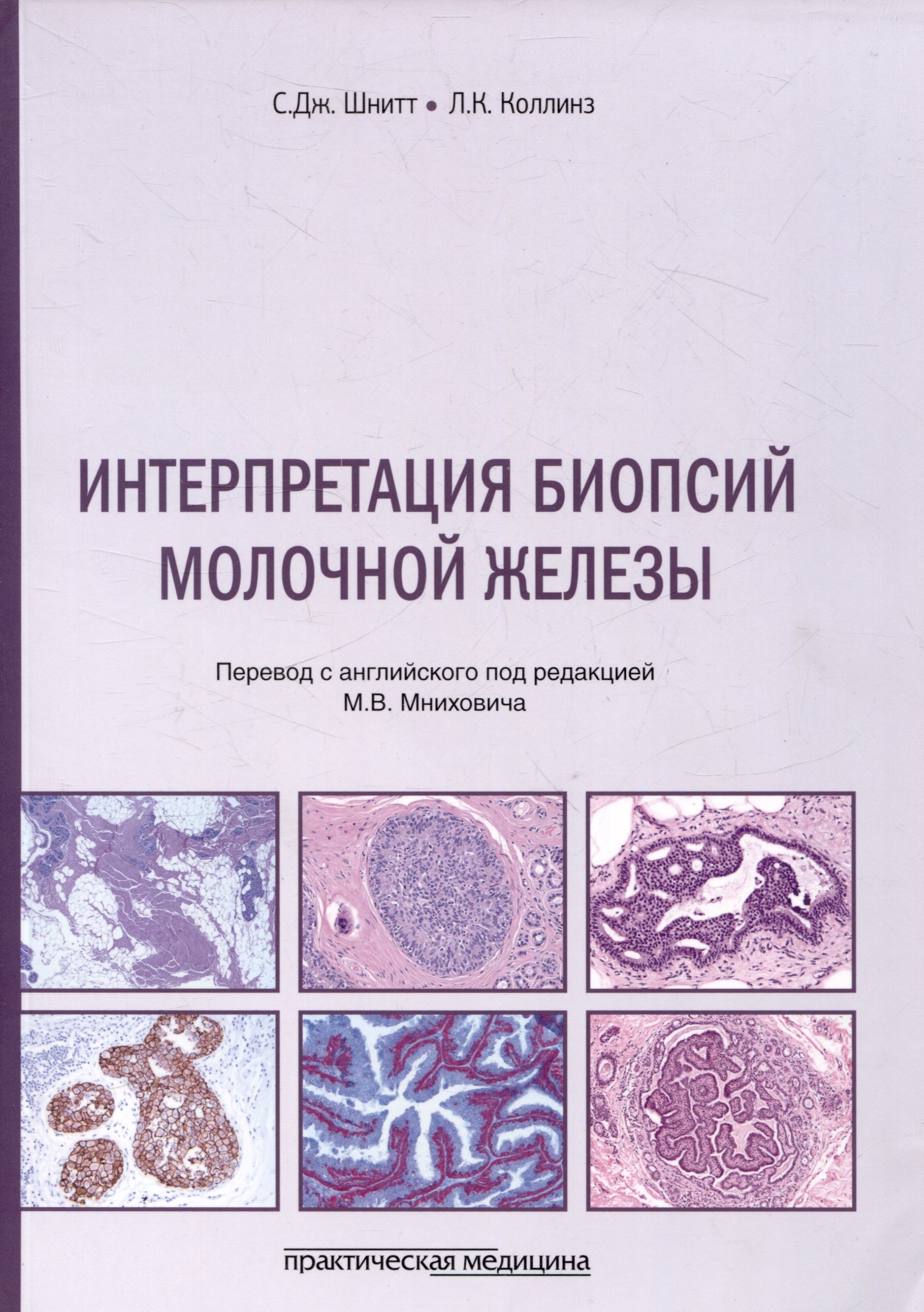 

Интерпретация биопсий молочной железы