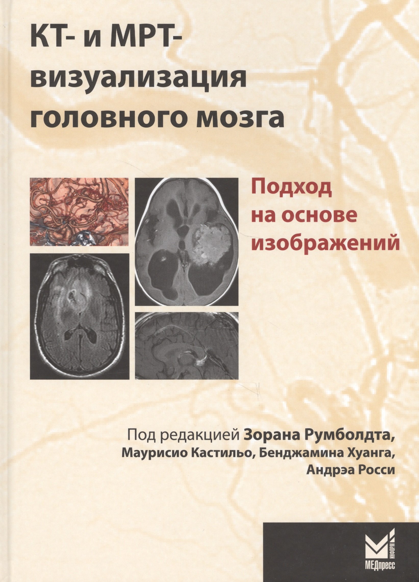 

КТ-и МРТ-визуализация головного мозга.подход на основе