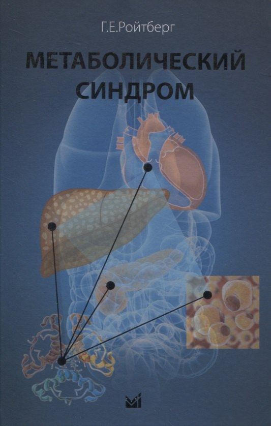 

Метаболический синдром