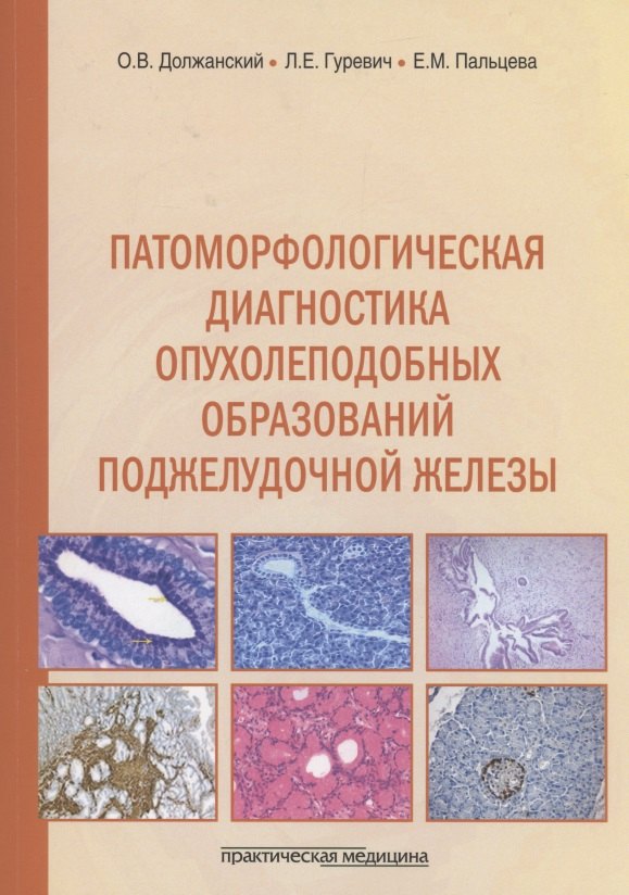 

Патоморфологическая диагностика опухолеподобных образований поджелудочной железы. Руководство для врачей