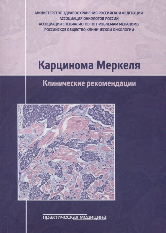 Карцинома Меркеля Клинические рекомендации 516₽