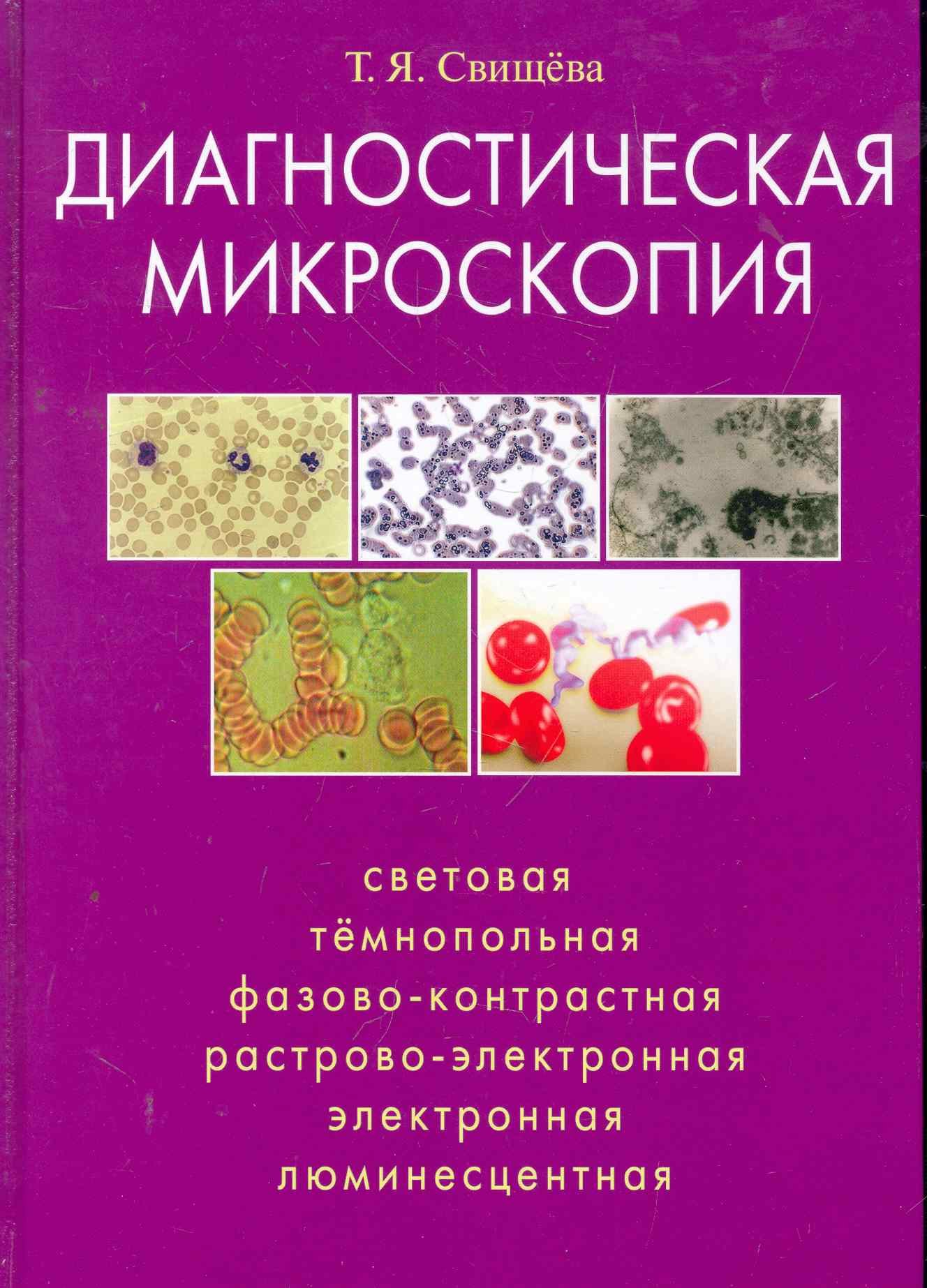 Свищева Тамара Яковлевна: Диагностическая микроскопия: сетевая, тёмнопольная, фазовоконтрольная, растрово-электронная, люминес