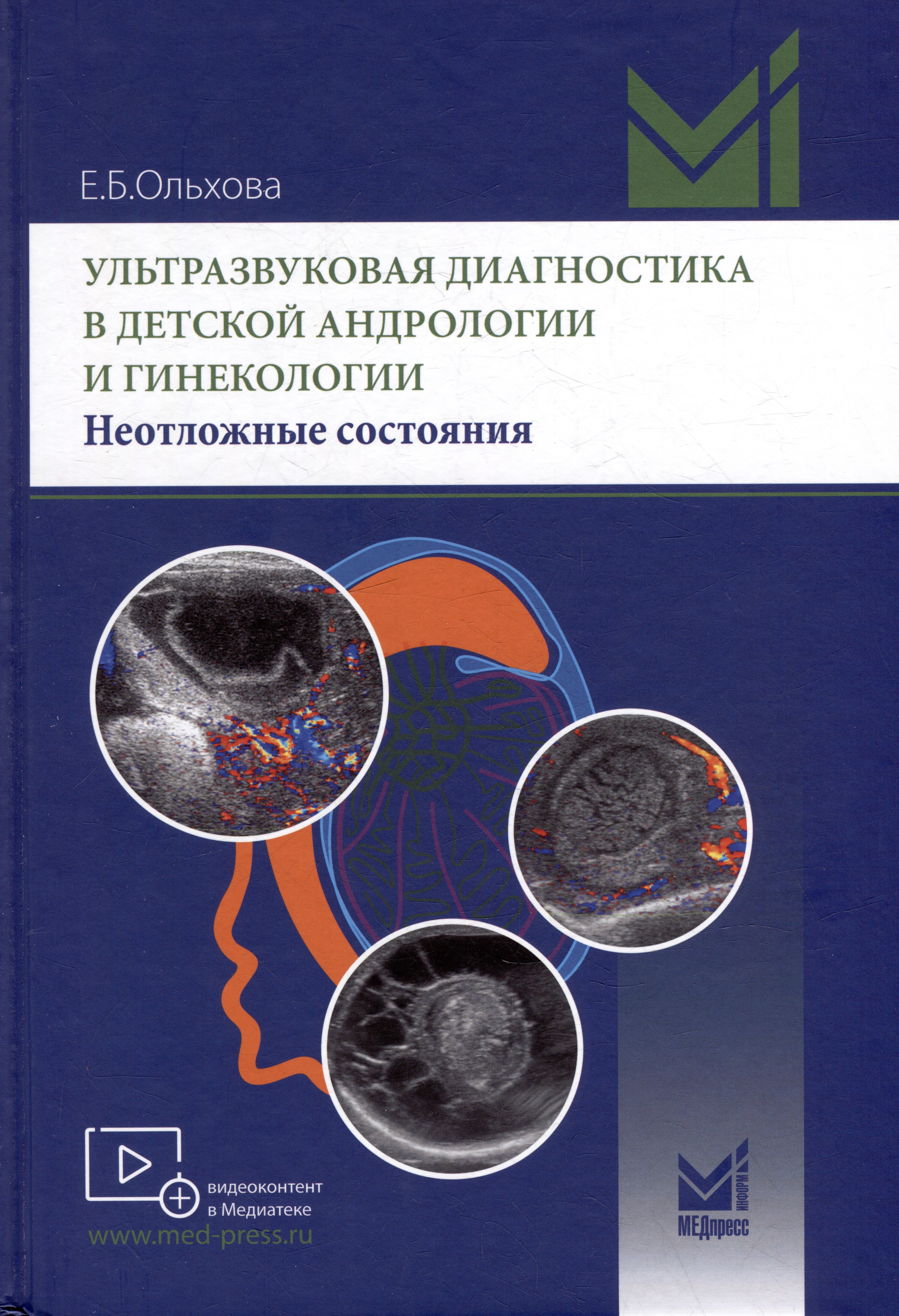 Ультразвуковая диагностика в детской андрологии и гинекологии. Неотложные состояния