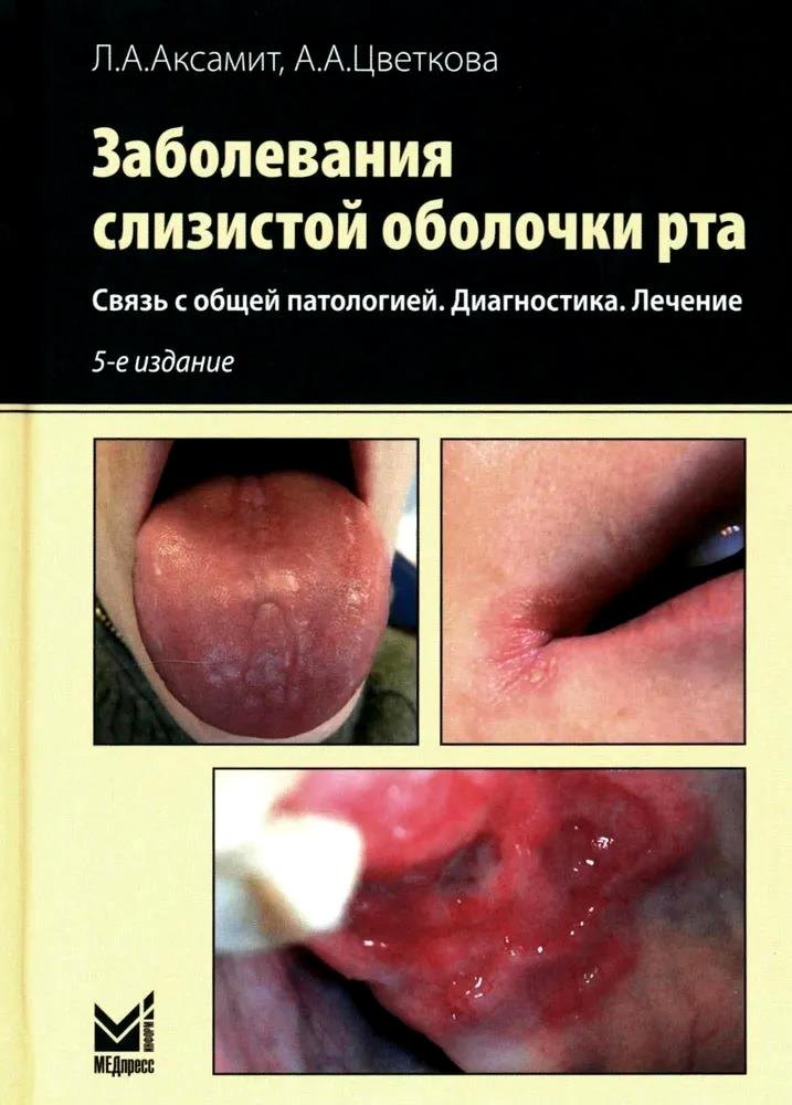 

Заболевания слизистой оболочки рта. Связь с общей патологией. Диагностика. Лечение
