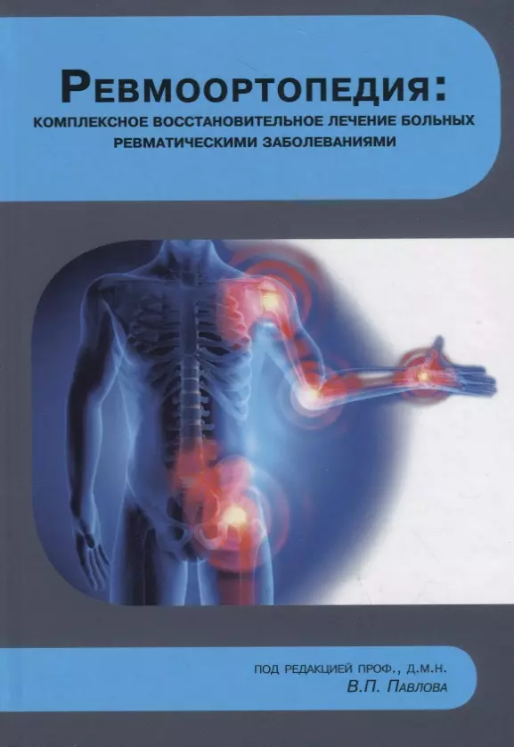 Ревмоортопедия: комплексное восстановительное лечение больных ревматическими заболеваниями