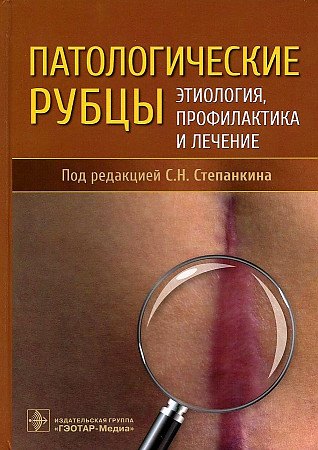 

Патологические рубцы. Этиология, профилактика и лечение