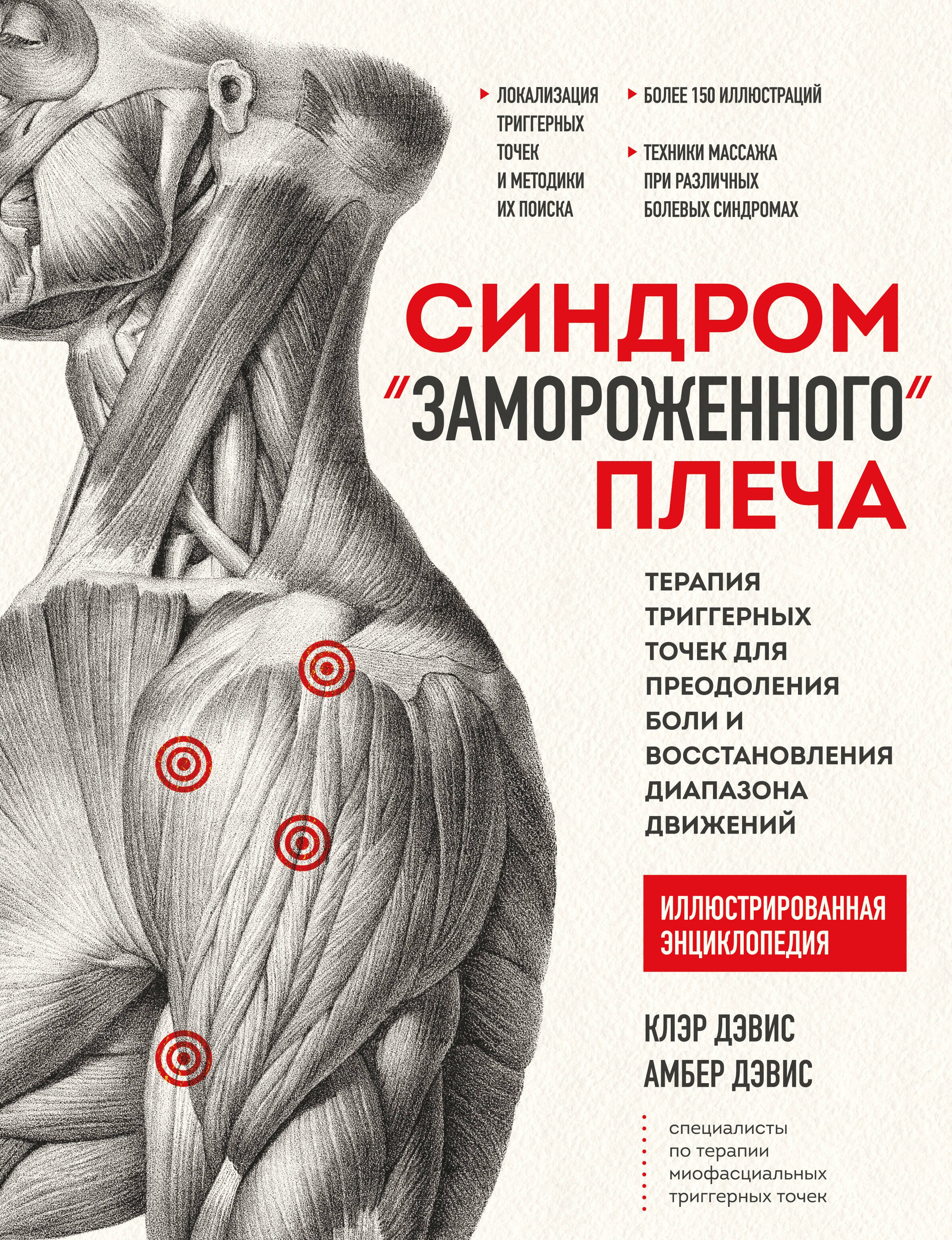 Клэр Дэвис: Синдром &quot;замороженного&quot; плеча. Терапия триггерных точек для преодоления боли и восстановления диапазона движений