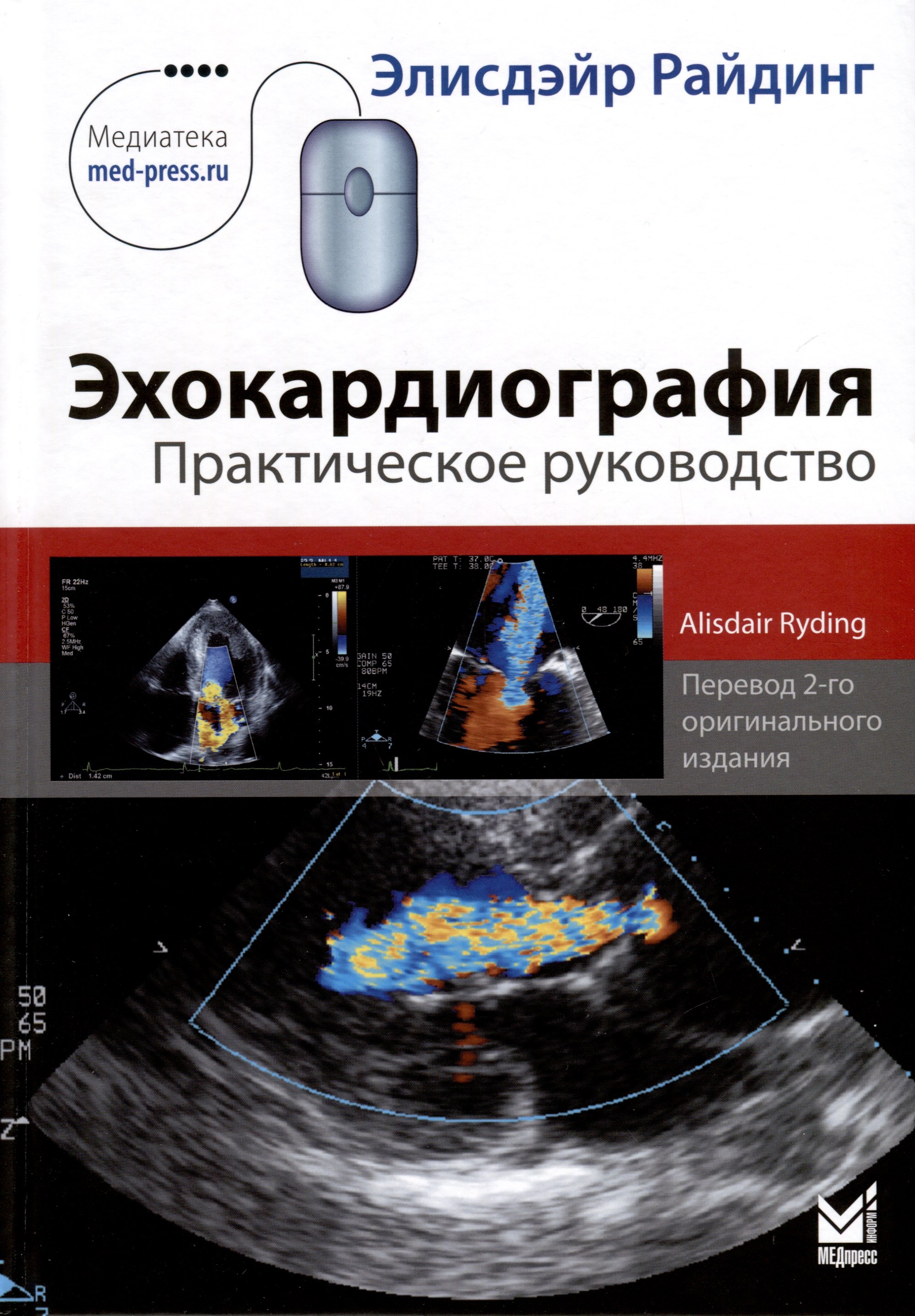 Эхокардиография Цена