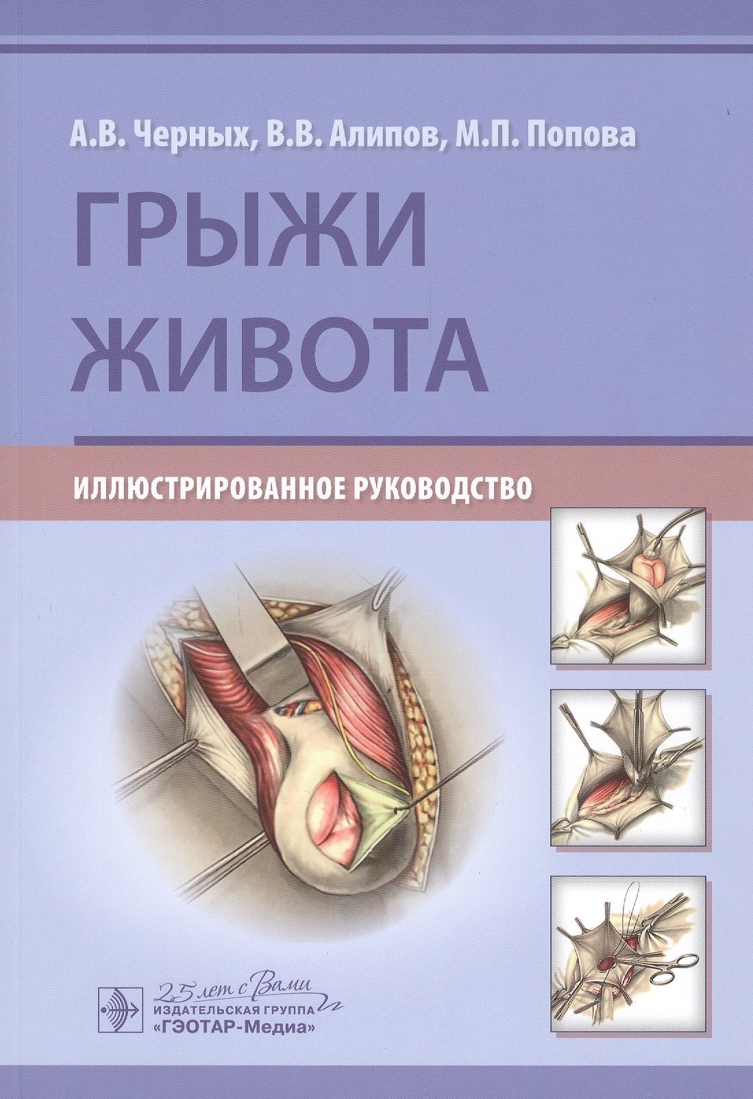 

Грыжи живота: Иллюстрированное руководство