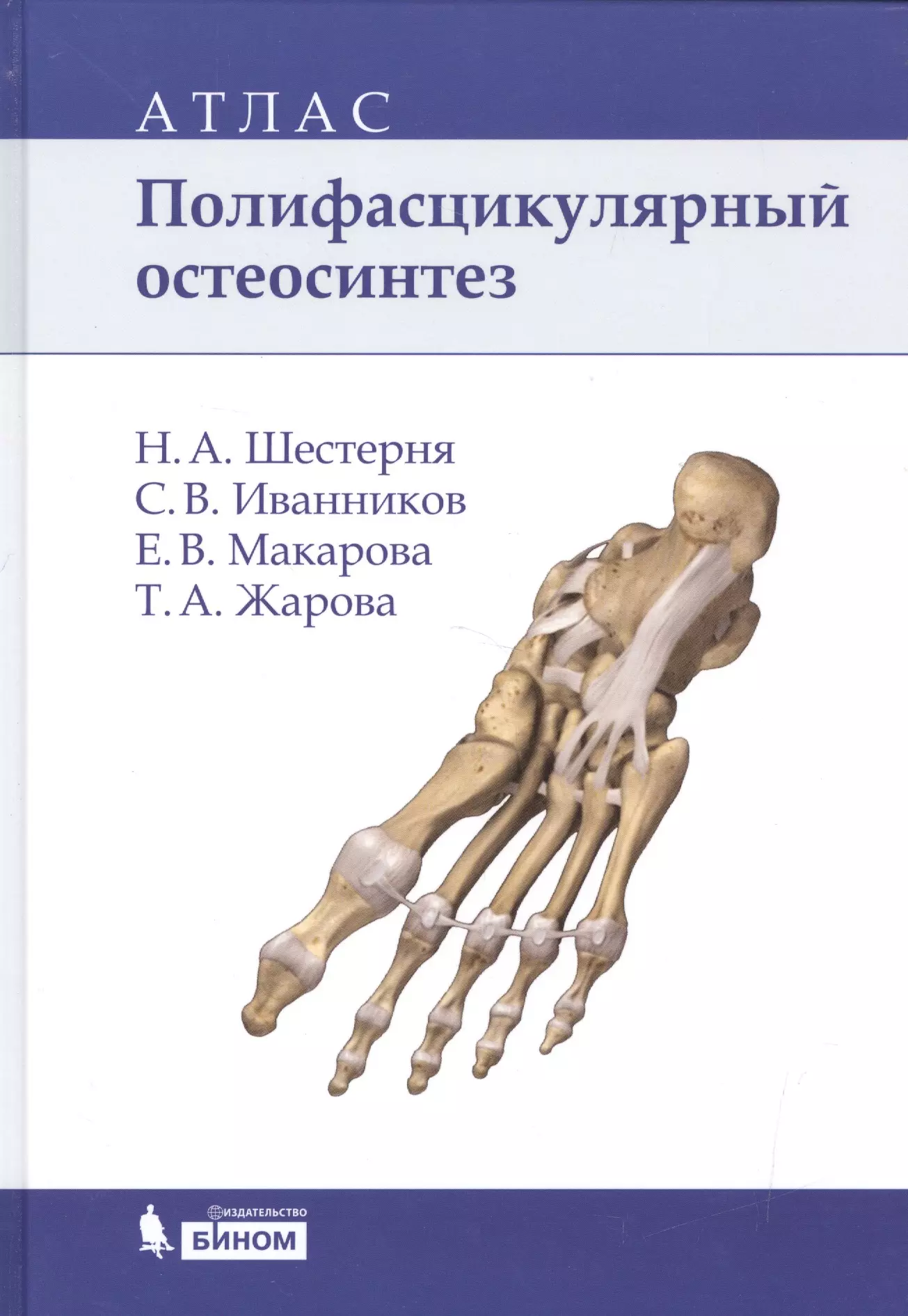 Полифасцикулярный остеосинтез: атлас