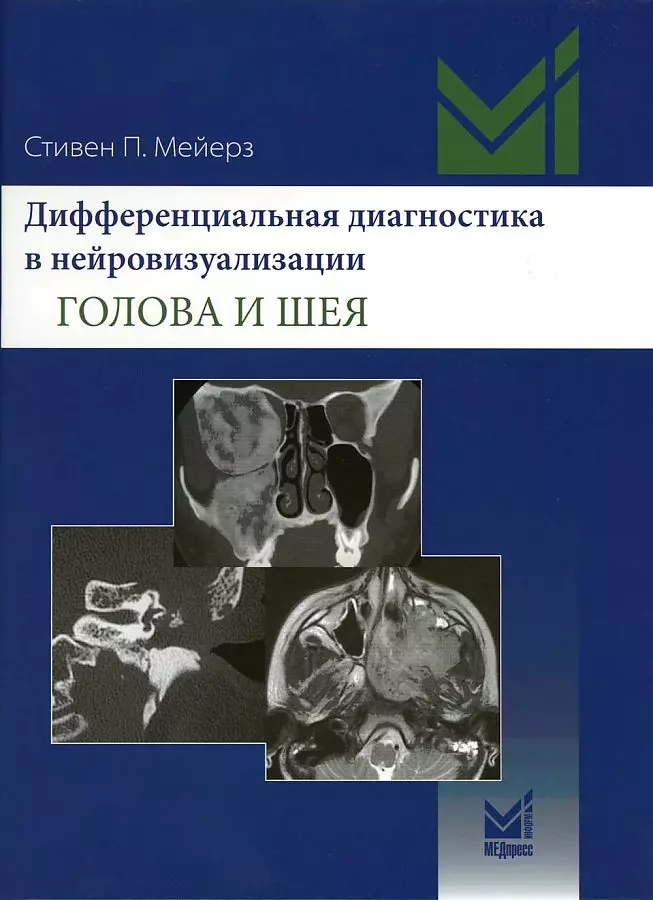 

Дифференциальная диагностика в нейровизуализации. Голова и шея