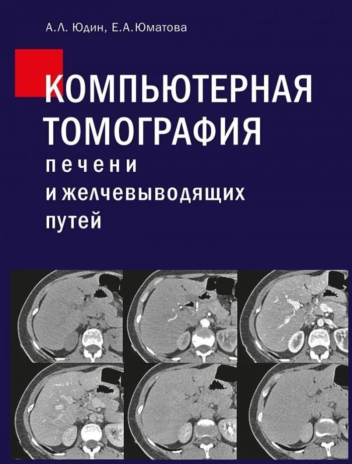 

Компьютерная томография печени и желчевыводящих путей: практическое руководство.