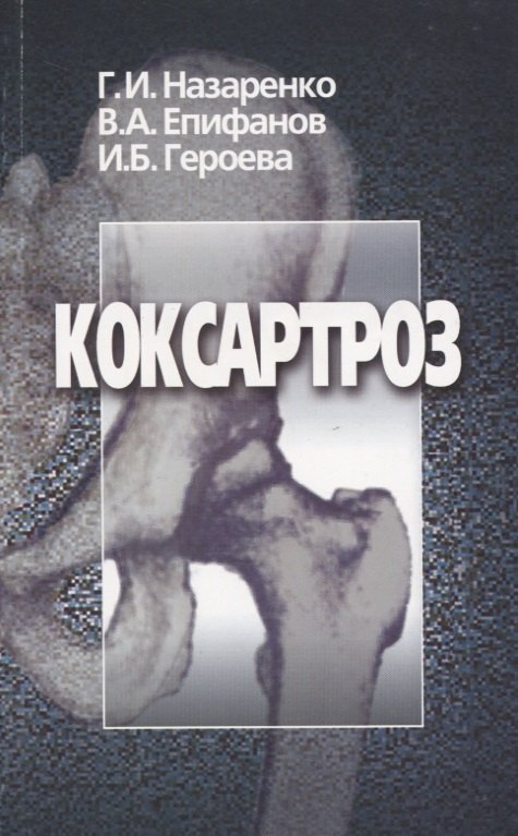 

Коксартроз