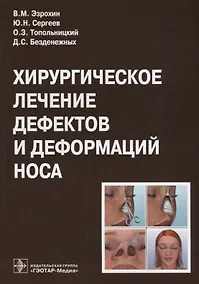 Купить Хирургическое лечение дефектов и деформаций носа — Фото №1