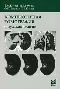 Купить Компьютерная томография в пульмонологии — Фото №1