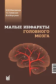 Купить Малые инфаркты головного мозга — Фото №1