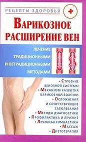 Купить Рецепты здор:Варикозное расширение вен — Фото №1