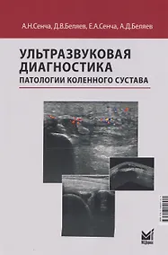 Купить Ультразвуковая диагностика патологии коленного сустава — Фото №1