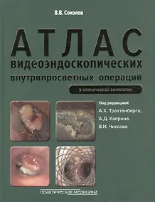 Купить Атлас видеоэндоскопических внутрипросветных операций в клинической онкологии — Фото №1