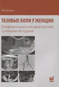Купить Тазовые боли у женщин Дифференциальная диагностика лучевыми методами (м) Холин — Фото №1