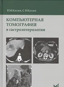 Купить Компьютерная томография в гастроэнтерологии — Фото №1