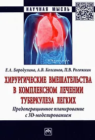 Купить Хирургические вмешательства в комплексном лечении туберкулеза легких. Предоперационное планирование — Фото №1