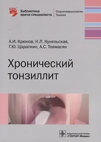 Купить Хронический тонзиллит — Фото №1