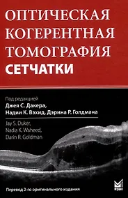 Купить Оптическая когерентная томография сетчатки. Перевод 2-го оригинального издания — Фото №1