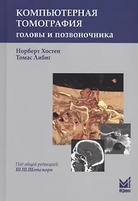 Купить Компьютерная томография головы и позвоночника — Фото №1