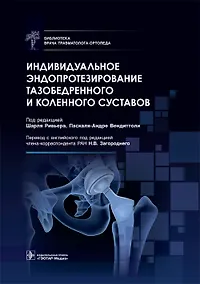 Купить Индивидуальное эндопротезирование тазобедренного и коленного суставов — Фото №1