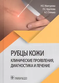 Купить Рубцы кожи. Клинические проявления, диагностика и лечение — Фото №1