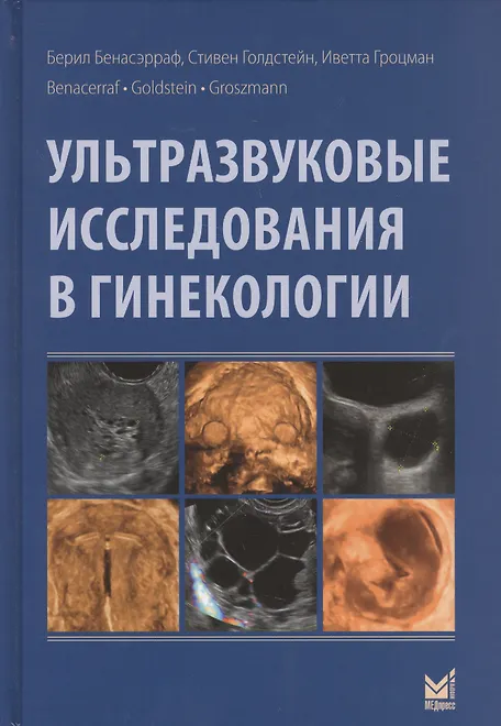 Купить Ультразвуковые исследования в гинекологии — Фото №1