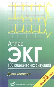 Купить Атлас ЭКГ. 150 клинических ситуаций — Фото №1