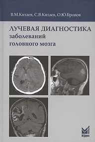 Купить Лучевая диагностика заболеваний головного мозга. 3-е издание — Фото №1