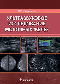 Купить Ультразвуковое исследование молочных желез — Фото №1