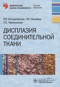 Купить Дисплазия соединительной ткани — Фото №1