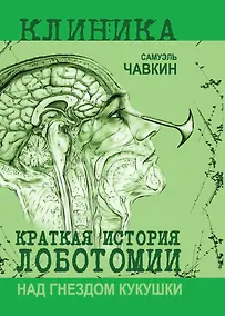 Купить Над гнездом кукушки. Краткая история лоботомии — Фото №1