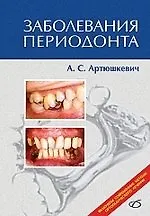 Купить Заболевания периодонта — Фото №1