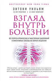 Купить Взгляд внутрь болезни. Все секреты хронических и таинственных заболеваний и эффективные способы их полного исцеления — Фото №1