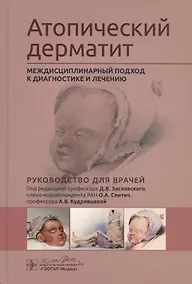 Купить Атопический дерматит. Междисциплинарный подход к диагностике и лечению. Руководство для врачей — Фото №1