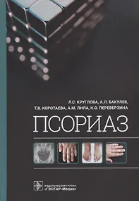 Купить Псориаз — Фото №1