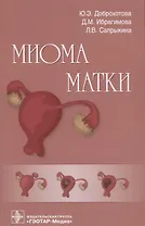Купить Миома матки — Фото №1