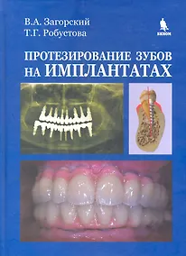Купить Протезирование зубов на имплантатах. — Фото №1