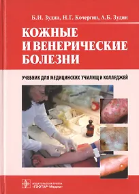 Купить Кожные и венерические болезни. 2-е изд. — Фото №1