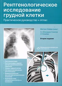 Купить Рентгенологическое исследование грудной клетки. Практическое руководство. Атлас — Фото №1